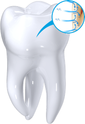 How Teeth Whitening Works
